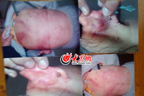 　山東藝術(shù)設(shè)計(jì)學(xué)院16歲女生宿舍內(nèi)被女同學(xué)暴打4小時(shí)。