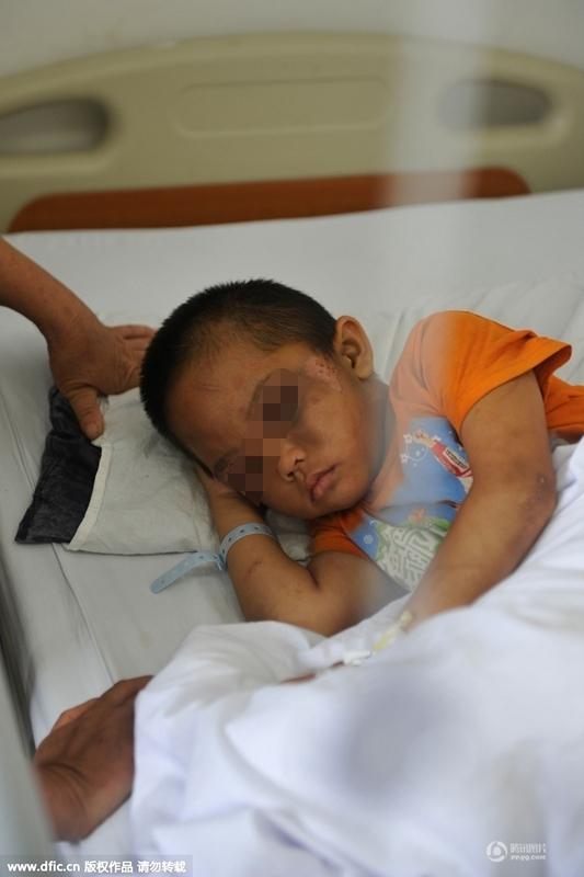 圖為全身傷痕累累的小進(jìn)。