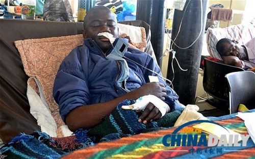 雖然已經(jīng)在醫(yī)院接受了近一個(gè)月的恢復(fù)治療，卡托卡的身體仍然非常虛弱。