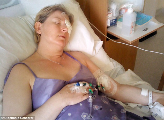 恐怖慎入！隱形眼鏡致英女子摘除眼球