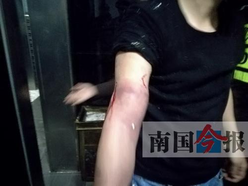 覃先生手臂被卡的部位受傷流血，所幸傷勢(shì)無大礙。 通訊員 王建民 攝