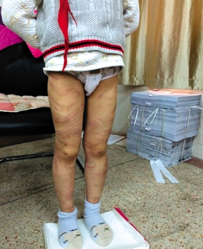 4月3日晚，微博網(wǎng)友“@朝廷半日閑”發(fā)圖文微博展示男童被虐待的慘狀。 微博截圖