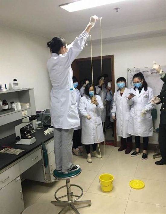 愛(ài)吃生肉惹的禍！男子體內(nèi)取出5米長(zhǎng)寄生蟲(圖)