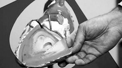 威廉斯領(lǐng)導(dǎo)的研究團(tuán)隊(duì)已經(jīng)利用人體脂肪干細(xì)胞，成功3D打印出心臟血管和心臟瓣膜，待一顆心臟的所有部件打