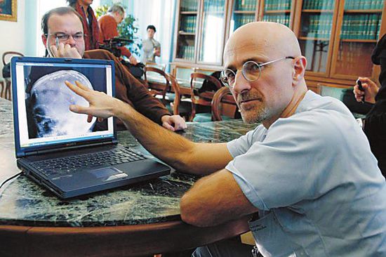 圖為卡納維洛醫(yī)生，不少人認(rèn)為他的想法非常瘋狂