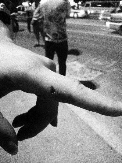 民警食指被咬傷。