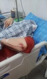 砸窗當(dāng)事人胡女士在醫(yī)院接受治療。