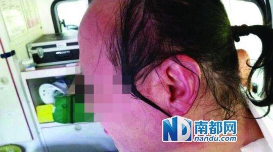 涉事教師遭熱水潑臉后的照片。