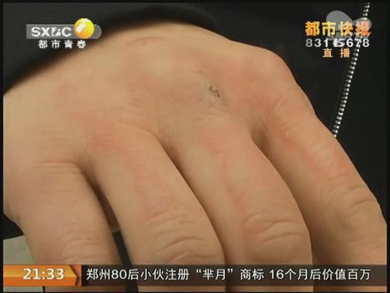 說到這足療拔罐，估計大伙都不陌生，但是想起4號晚上的拔罐的經(jīng)歷，呂先生現(xiàn)在想起來，還心有余悸。