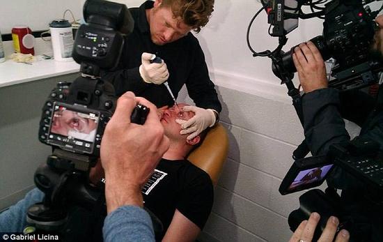 該實(shí)驗(yàn)是由加州一支名為“生物駭客”的實(shí)驗(yàn)團(tuán)隊(duì)開(kāi)展的。他們使用了一種名為二氫卟吩e6（Ce6）的物質(zhì)的溶液。Ce6常見(jiàn)于深海魚(yú)體內(nèi)，有光敏特性，通常用于癌癥治療研究中。研究團(tuán)隊(duì)將Ce6與胰島素和鹽水混合起來(lái)，得到一種溶液，可以在低光照條件下提高人類(lèi)的視力。