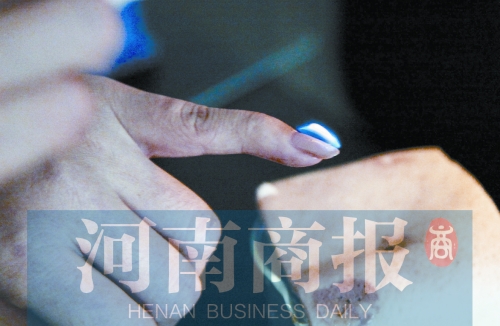 將指甲油涂在指甲上，靠近火焰時(shí)被引燃了