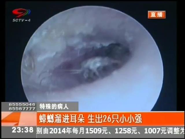 小強(qiáng)溜進(jìn)耳朵？生26只小小強(qiáng)