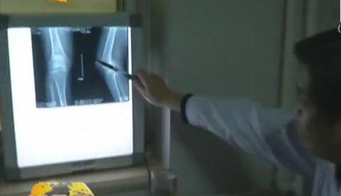 冷空氣來襲 如何預(yù)防老寒腿？